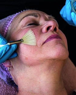 peeling aanbrengen